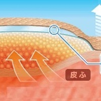 乾燥ストレスを「潤い」でケア『モイストヒーリング』の仕組み