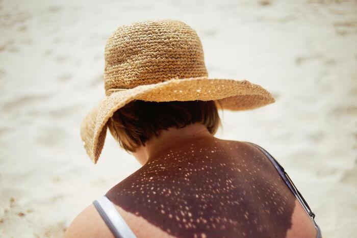 日本の夏は、高温多湿。髪に覆われた頭皮は、とっても蒸れやすいんです。汗や皮脂が、毛穴に詰まると抜け毛の原因になってしまったり、においの原因になってしまいます。毎日のシャンプーで、汚れをしっかり落とすことが大切です。