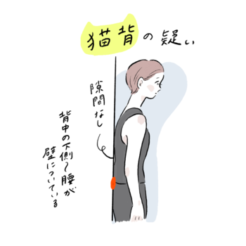 猫背とは、背骨が正しい形であるS字カーブを保てず、丸くなっている状態です。さらに、頭が前に出ているのが特徴。