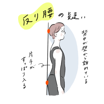反り腰とは、腰が過剰に反り、骨盤が前に傾いている姿勢のこと。特に若い女性に多く見られる姿勢タイプで、お腹が前に出やすく太って見えてしまうことも。
